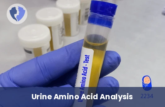 Urine Amino Acids Test