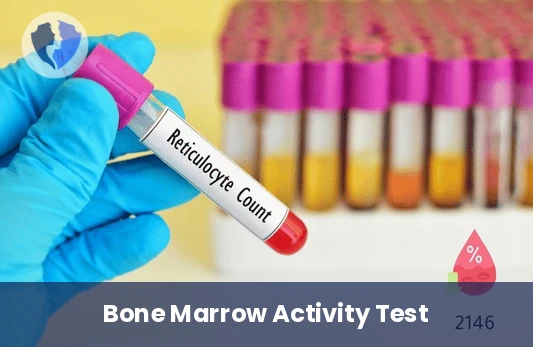 Reticulocyte Count Test