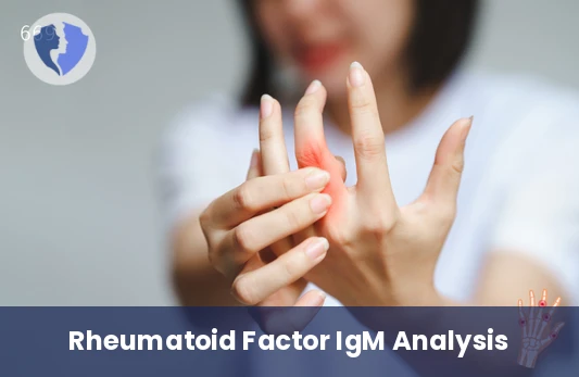 Rheumatoid Factor IgM Test - Rheumatoid Factor Isotype IgM Test