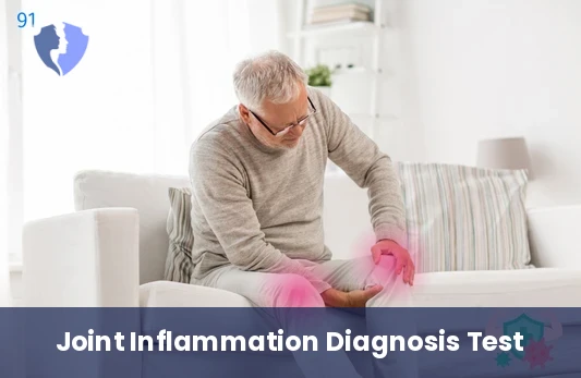 Rheumatoid Factor (RF) Test