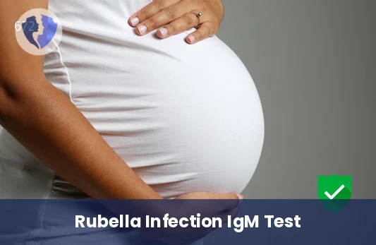 Rubella IgM Antibody Test