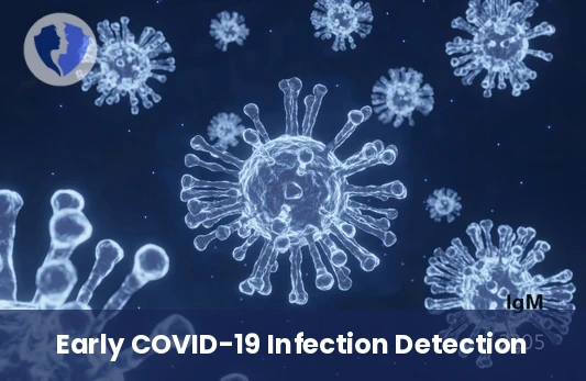 COVID-19 IgM Antibody Test - SARS-CoV-2 IgM Antibody Test