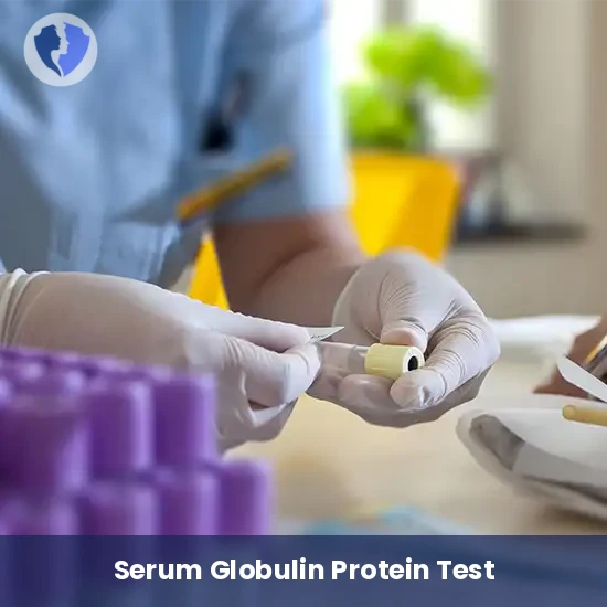 Serum Globulin Level Test - Serum Globulin Test