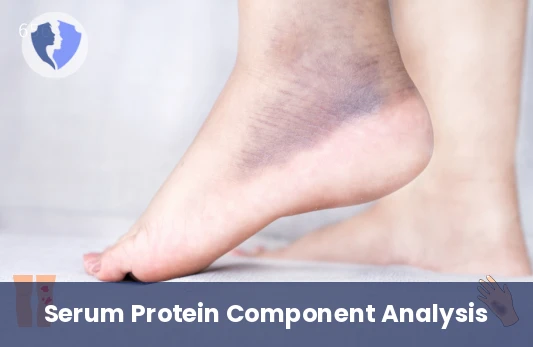 Serum Protein Electrophoresis Test - Serum Protein Electrophoresis (SPEP)