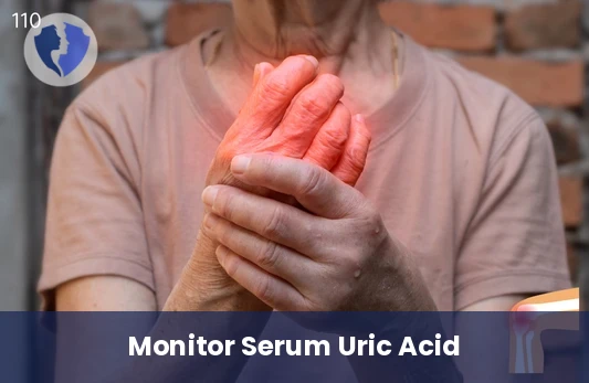 Uric Acid Test for Gout Prevention - Serum Uric Acid Test
