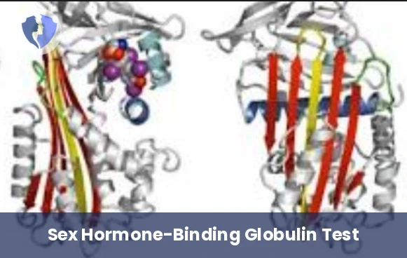 Sex Hormone-Binding Globulin Test - Sex Hormone-Binding Globulin (SHBG) Test