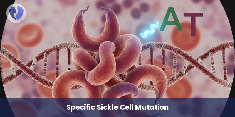 Sickle Cell Mutation Test - Sickle Cell Anemia Mutation Test (HBB) C.20A>T
