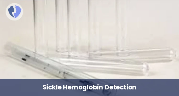 Sickle Cell Solubility Test