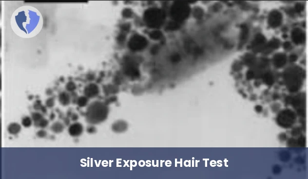 Silver Hair Analysis