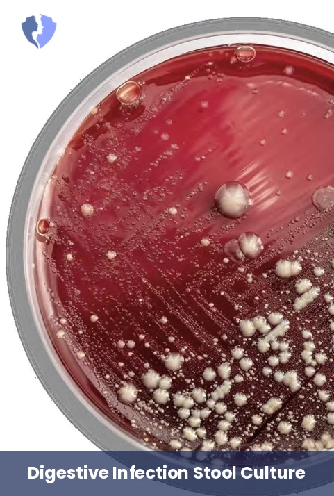 Comprehensive Stool Culture - Stool Culture and Sensitivity