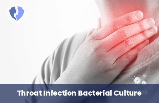 Throat Swab Culture Test - Throat Swab Culture and Sensitivity