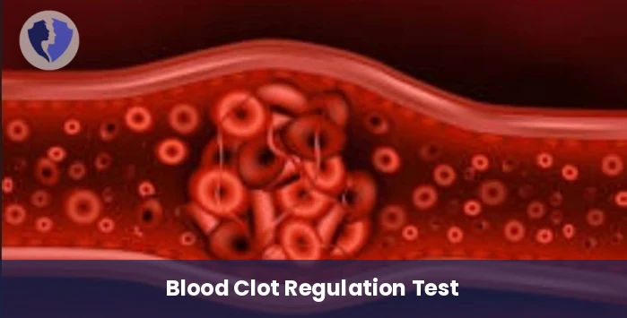 Blood Clot Risk Test - Tissue Plasminogen Activator (t-PA) Test