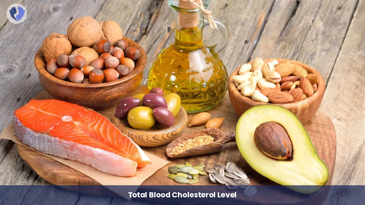Total Cholesterol Heart Test - Total Cholesterol Test