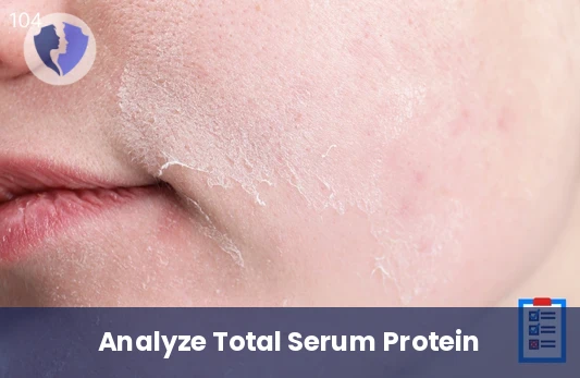 Check Your Total Protein Balance - Total Protein Serum Test