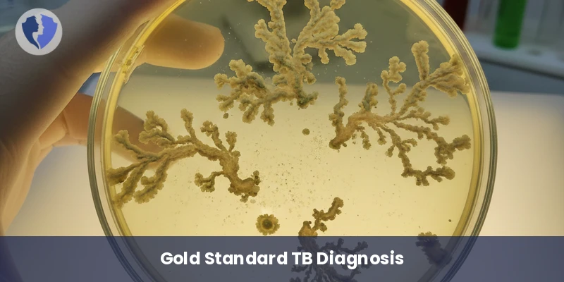 Tuberculosis (TB) Culture