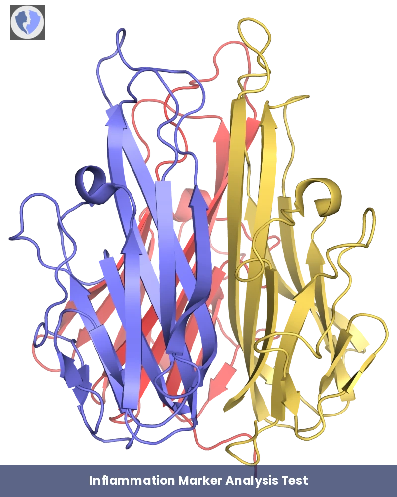 TNF Inflammation Test - Tumor Necrosis Factor (TNF) Test