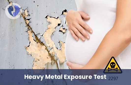 Urine Lead Toxicity Test - Urine Lead Test