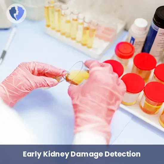 Urine Microalbumin Test