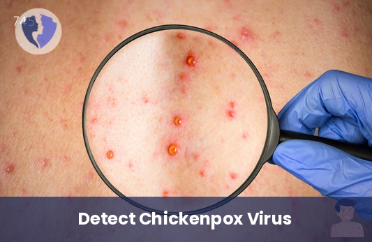 Accurate Chickenpox Virus Detection - Varicella Zoster Virus Real-Time PCR Test