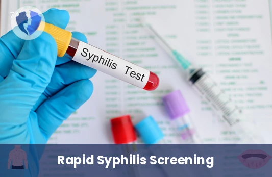 Accurate Syphilis Screening Test - VDRL Syphilis Test