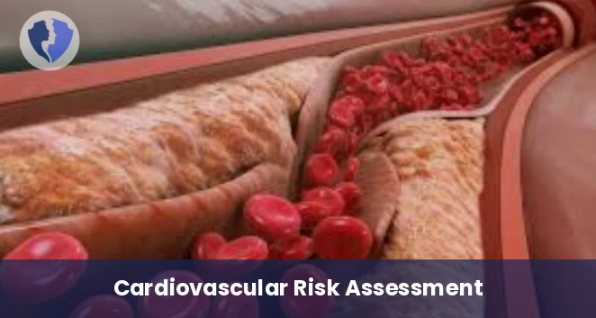 VLDL Cholesterol Test - Very Low-Density Lipoprotein (VLDL) Test
