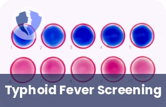 Widal Test for Typhoid