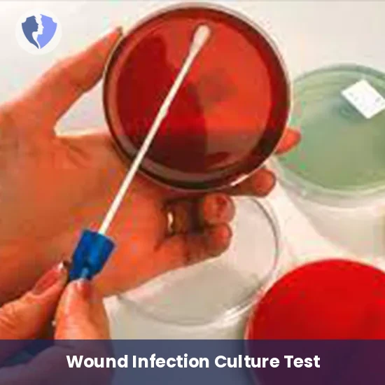 Wound Swab Culture Test - Wound Swab Culture and Sensitivity