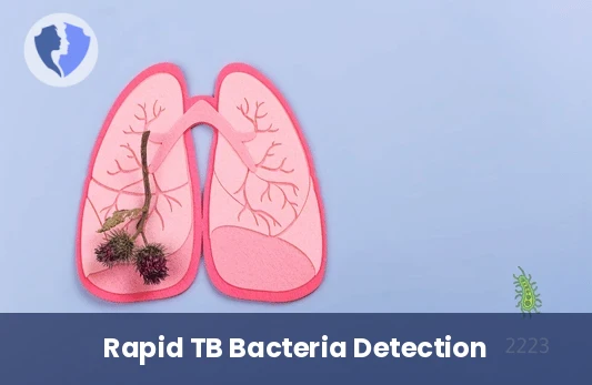 Rapid TB Stain Test - Ziehl-Neelsen (ZN) Stain for TB