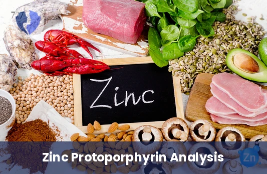 Check Your Zinc and Iron Balance - Zinc Protoporphyrin (ZPP) Test
