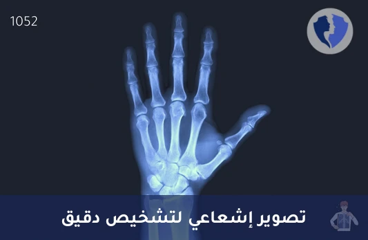 خدمة التصوير بالأشعة السينية - أشعة سينية (X-Ray)