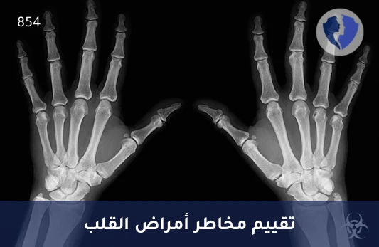 فحص قياس تكلس الشرايين التاجية - أشعة مقطعية لقياس تكلس الشرايين التاجية (Calcium Scoring)