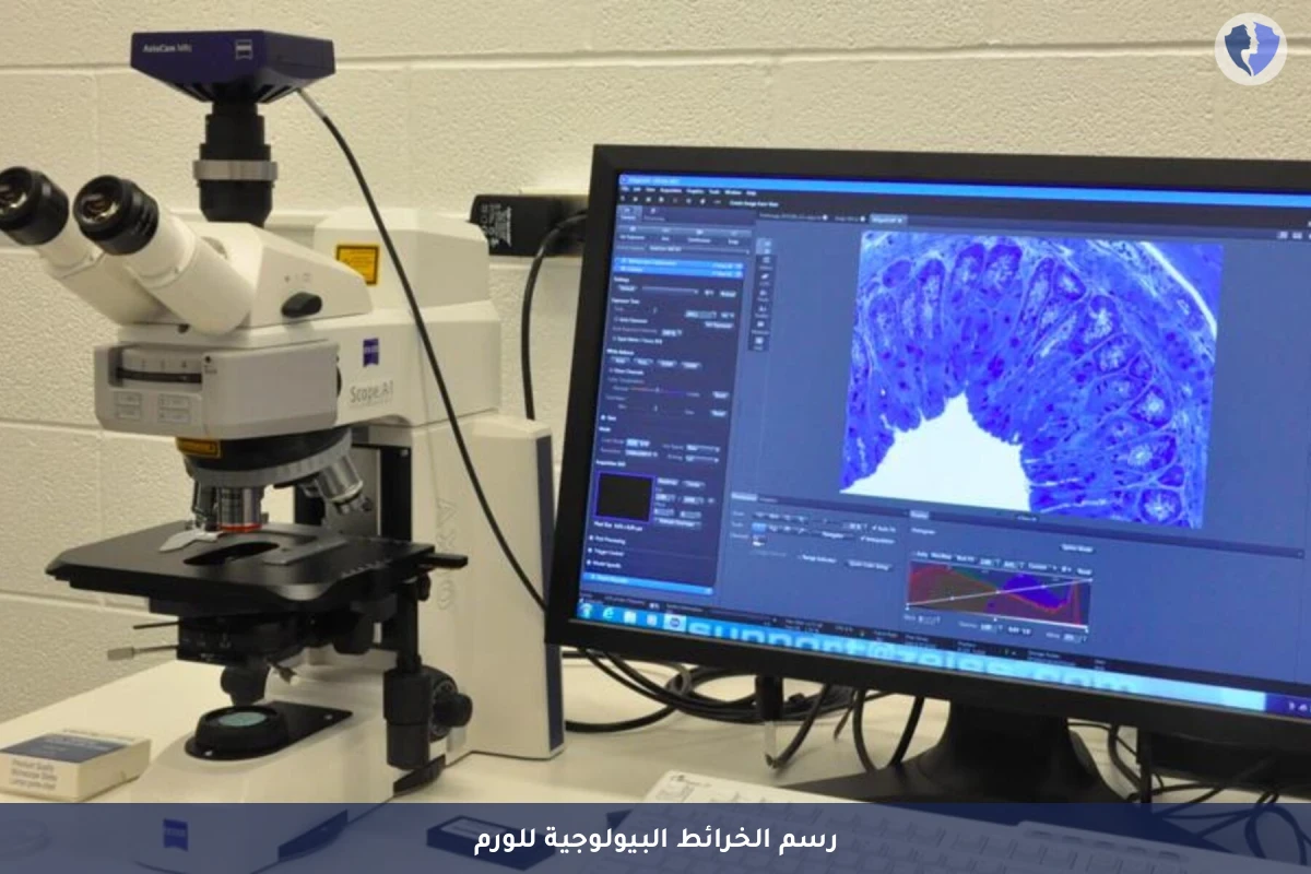 خريطة مناعية شاملة للأورام المعقدة - استشارة وتفسير نتائج الكيمياء النسيجية المناعية - 14 علامة (14 Markers)