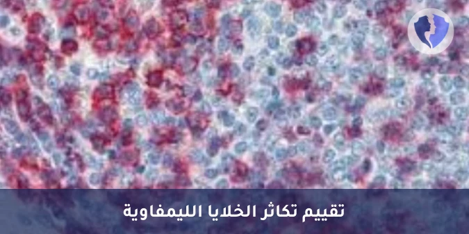 باقة تمييز أورام الخلايا التائية - باقة تحليل الكيمياء النسيجية المناعية (CD43)