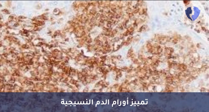 تشخيص أورام الدم والأنسجة - باقة تحليل الكيمياء النسيجية المناعية (CD45)