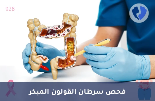 فحص الكشف المبكر عن سرطان القولون - باقة فحص سرطان القولون