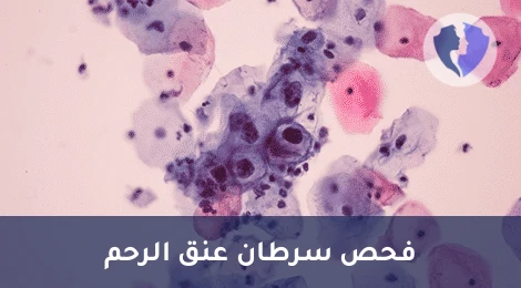 فحص عنق الرحم المتكامل - باقة فحص فيروس الورم الحليمي ومسحة عنق الرحم (HPV + LBC)