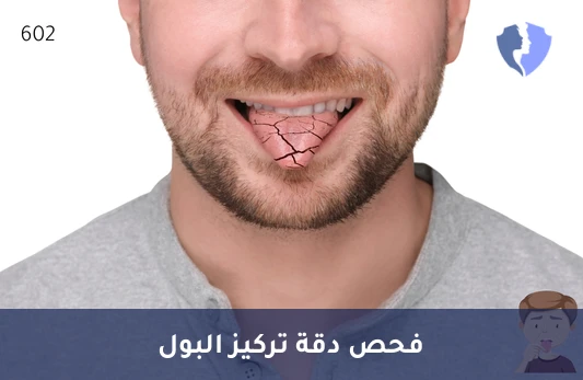 اطمئن على صحة الكلى - تحليل أسمولالية البول (Urine Osmolality)