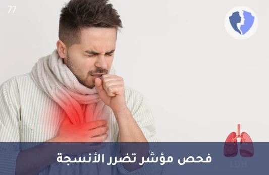 تحليل إنزيم LDH - تحليل إنزيم لاكتات ديهيدروجيناز (LDH)