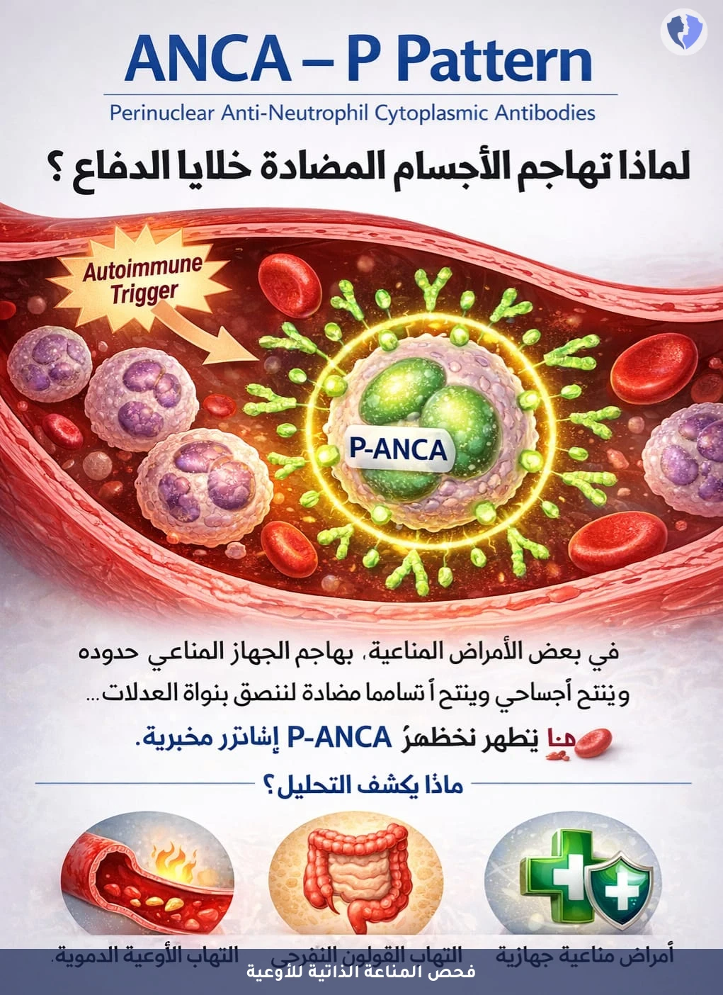 فحص الأجسام المضادة للأوعية - تحليل الأجسام المضادة السيتوبلازمية للعدلات (ANCA)