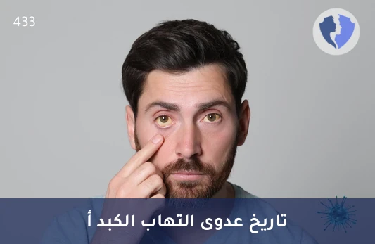 فحص مناعة التهاب الكبد (أ) - تحليل الأجسام المضادة الكلية لفيروس التهاب الكبد أ (HAV Total)