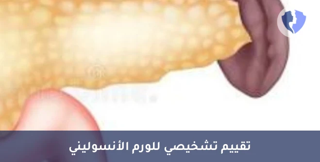 فحص أورام البنكرياس المفرزة للأنسولين - تحليل الأجسام المضادة المرتبطة بالورم الأنسوليني (Insulinoma Associate