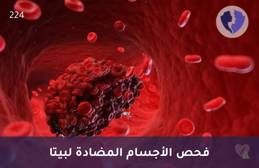 راقب توازن تجلط الدم - تحليل الأجسام المضادة لبيتا 2 غليكوبروتين 1 (B2 Glycoprotein I IgM)