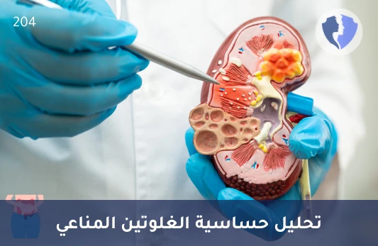 مراقبة صحة الجهاز الهضمي - تحليل الأجسام المضادة لترانسجلوتاميناز الأنسجة IgG (Anti-tTG IgG)