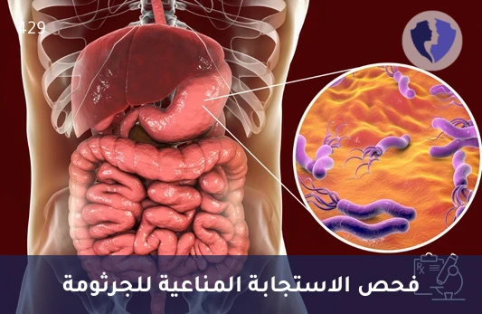 فحص أجسام جرثومة المعدة IgA - تحليل الأجسام المضادة لجرثومة المعدة (H. pylori IgA)