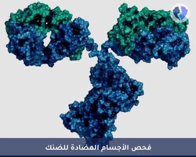 فحص حمى الضنك (IgM) - تحليل الأجسام المضادة لحمى الضنك (Dengue Virus IgM)