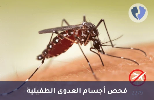 فحص الأجسام المضادة للفيلاريا - تحليل الأجسام المضادة لداء الفيلاريات (Filaria IgG)