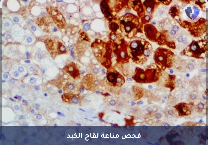 فحص مناعة الكبد الوبائي (ب) - تحليل الأجسام المضادة لسطح فيروس التهاب الكبد ب (HBsAb)