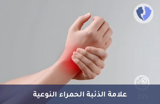 فحص الذئبة الحمراء النوعي - تحليل الأجسام المضادة لسميث (Anti-Smith Abs)