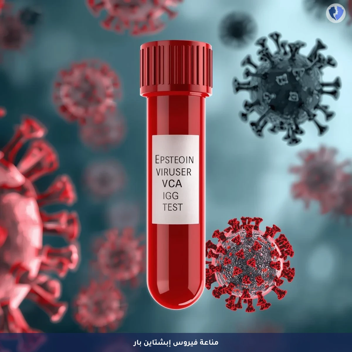 فحص مناعة فيروس إبشتاين-بار - تحليل الأجسام المضادة لفيروس إبشتاين بار (EBV VCA IgG)