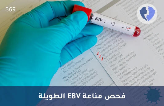 تحقق من مناعتك ضد إبشتاين-بار - تحليل الأجسام المضادة لفيروس إبشتاين-بار النوع ج (EBV IgG)